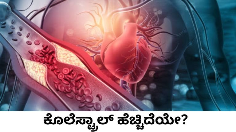 ಕೊಲೆಸ್ಟ್ರಾಲ್ ಹೆಚ್ಚಿದೆಯೇ?